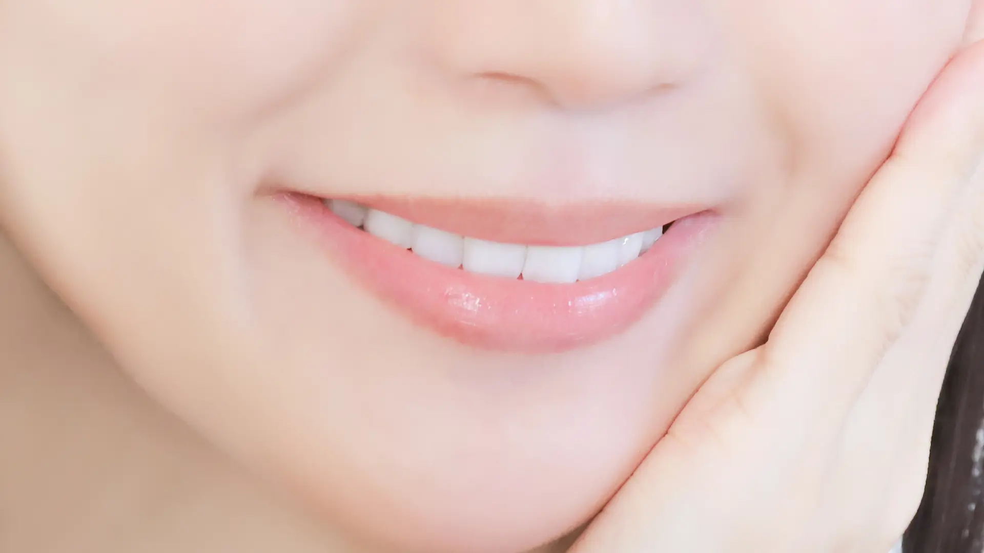 ダイレクトボンディングとは